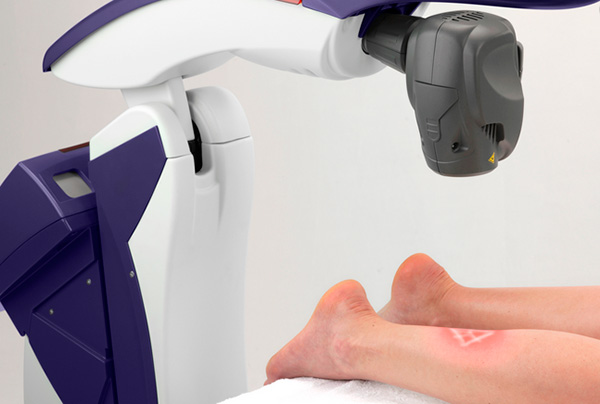 درمان درد پا با لیزر رباتیک m6