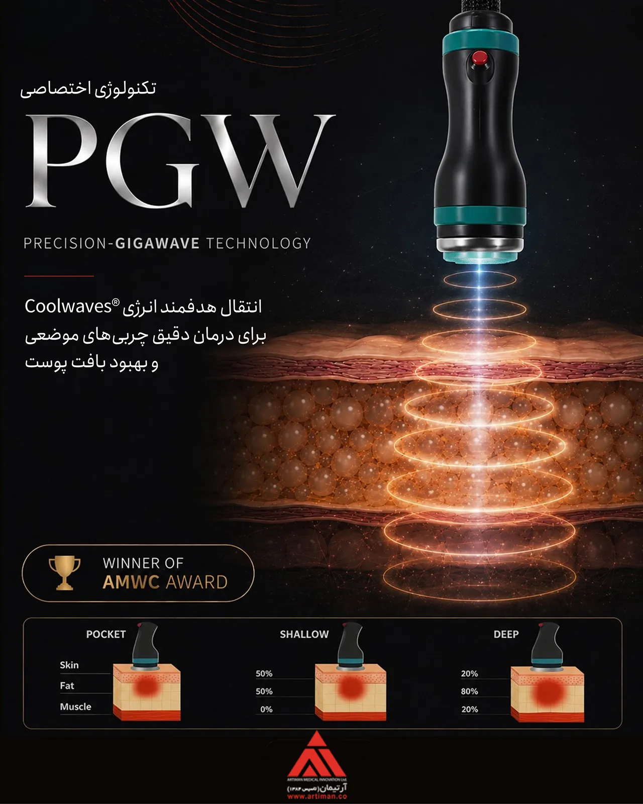 فناوری PGW و امواج کول ویو مورد استفاده در دستگاه لاغری اوندا پرو